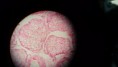 /album/fotos-microscopio/a19521-10152991621071696-6402196687018050561-n-jpg/