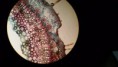 /album/fotos-microscopio/a10371491-10152991622196696-7828964003077238794-n-jpg/