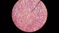 /album/fotos-microscopio/a11209574-10152991620746696-1030739452870995588-n-jpg/