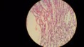 /album/fotos-microscopio/a11214223-10152991621161696-2471595840347739293-n-jpg/