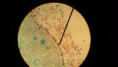 /album/fotos-microscopio/a11262487-10152991622956696-6089175784115654872-n-jpg/