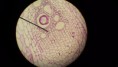 /album/fotos-microscopio/a11263132-10152991622921696-8500662282778971502-n-jpg/