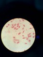 /album/fotos-microscopio/a11950821-10204778072953937-1432731988-n-jpg/